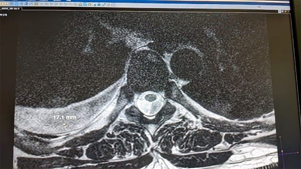 Клинический случай, который мог закончиться иначе