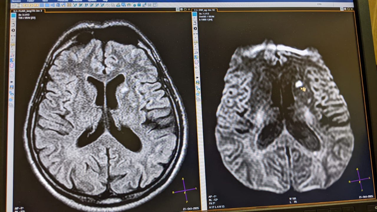 История о том, как неловкость при письме спасла жизнь