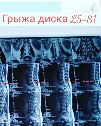Нужна операция!